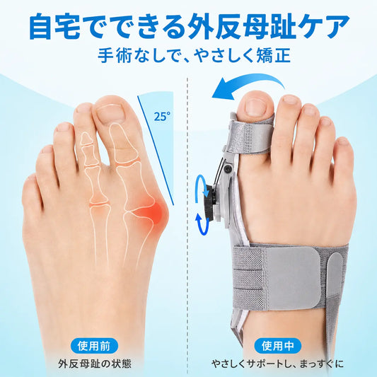 Yurelo | 外反母趾を自宅で矯正