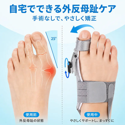 Yurelo | 外反母趾を自宅で矯正 - KAWSAYS